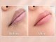 ワールドビューティー(World Beauty)の写真/【国家資格者施術】《半額モニター募集中》ローマピンクで話題!唇の黒ずみを桃色にする専門メラニンケア。