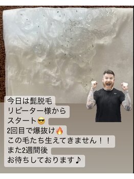 リリー(RILY)/【髭脱毛】