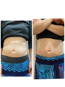 ルナート(Lunart)/美腸くびれモニター