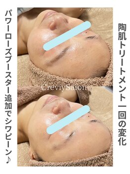 クレヴィー(Creviy)/陶肌トリートメント