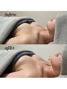 エルエーズ(Elleaise)/背中からデコルテまで徹底ケア!