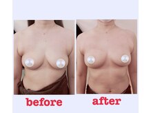 ブロッサム 山内店/1回でこの効果☆ウエストも変化