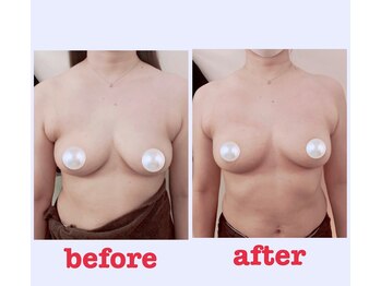 ブロッサム 山内店/1回でこの効果☆ウエストも変化