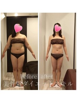 プルクラ プラス(PULCHRA)/美骨盤矯正before→after