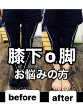 カワル整体 上通り院/【膝下O脚で悩まれる方へ】