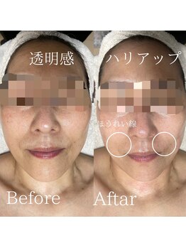 サロンディア(SALON Dea)/施術効果