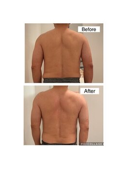 いおり骨盤整体 リブート(RE:BOOT)/メンズ痩身