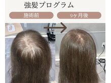 トウキ(TOUKI)の雰囲気（【強髪プログラム】取り扱いサロン頭皮のお悩みご相談ください）