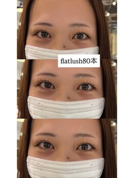 ビューティマーケット アングゥ(BEAUTY MARKET ungu)/パッチリデザイン