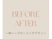 セレソル(CERESOL)/Wハーブピーリング×リンパ