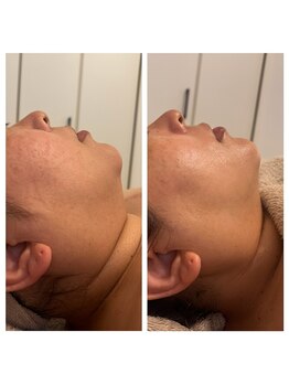 美温(mion)/横顔の造形美