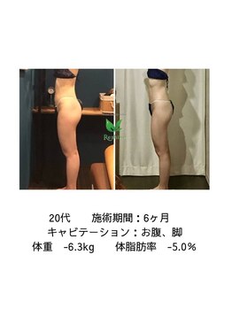 リシャイン(Reshine)/ビフォーアフター