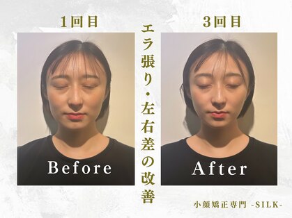 シルク(SILK)の写真