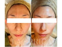 ラピリカ(LA PRICA)