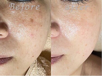 ゾーンビューティーハウス 柏店(ZONE BEAUTY HOUSE)の写真