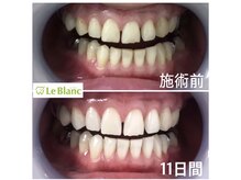 ルブラン 奈良店(Le Blanc)/印象変えるなら歯から！！