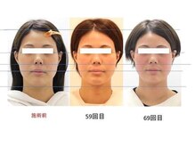 美キュール 栄店(cuol)/お客様BeforeAfter☆