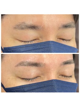 ブロウズ 新橋店(BROWS)/施術例