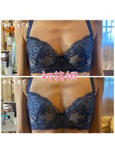 森の時計/症例写真:バスト編