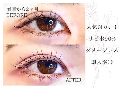 ハセミキ(Hase Miki)の写真