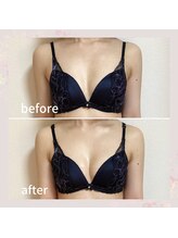 セレーネ(Selene)/お客様before.after