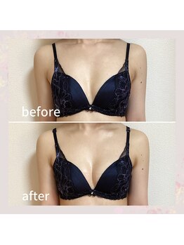 セレーネ(Selene)/お客様before.after