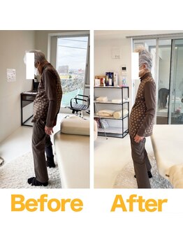 整体院ひなた 都城院/80代女性でも変わります！