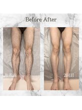 フォー(the 4)/before &nbsp;&nbsp;&nbsp;after