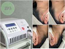 リル バイ アンドレ ビューティー(LiLL by Andre beauty)の雰囲気（安心の都度払い◎毛周期に合わせて来店ペースを決めていきます）