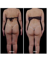 ボディケアルーム リフレキュア 中野(REFLECURE)/