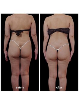 ボディケアルーム リフレキュア 中野(REFLECURE)/