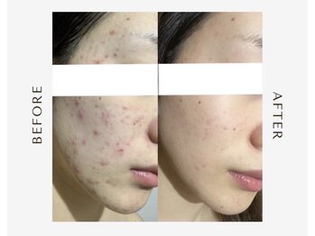 サロン ド ルル(salon de Lulu)/人気No. 1★セルキュア