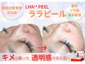 【韓国式最新美容♪60分】大人気ララピール♪しみシワ/ツヤ肌 (全顔+首)