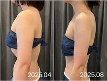 サロン ド ブラン アオヤマ(Salon de BLANC AOYAMA)/大人の為の徹底痩身ケア100分