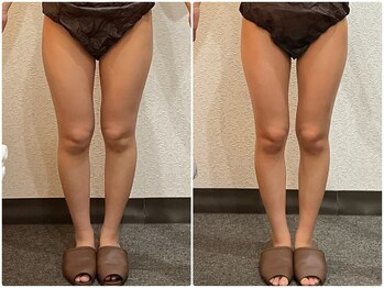 ウェリナ平和堂長久手院/小顔矯正/骨盤矯正/痩身/整体