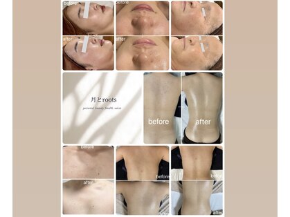 月とルーツ 大阪南堀江(月とroots)の写真