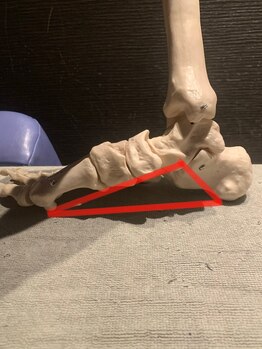 メディカルジャパン 吉祥寺/模型を使い専門的に説明します