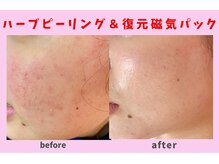 サロン ほほえむ(Fofo-m)の雰囲気（お肌トラブル改善・毛穴黒ずみ対策・お肌のトーンUPも叶います。）