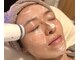 ハレノヒスパ 幕張店(HARENOHI SPA)の写真/【タイパ&コスパ最強◎】むくみ・たるみ改善に！引き上げてスッキリ小顔へ★施術後の変化を実感