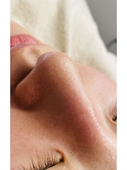 エモベーシック(e'MO BASIC)/大人気！ごっそり毛穴洗浄