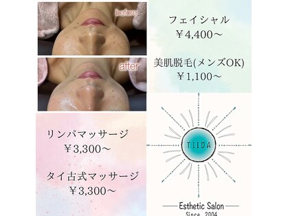 エステアンドタイ古式整体ティーダの写真