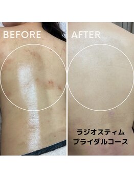 フェイエール鍼灸院 ラスィーヌ(fier鍼灸院 racine)/ブライダルコース