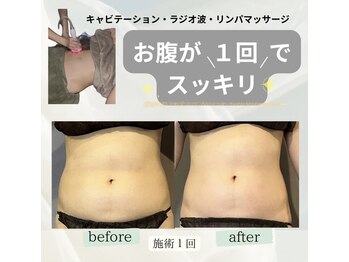 エネイブル(ENable)/