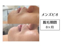 メンズビオ 神戸三宮店/