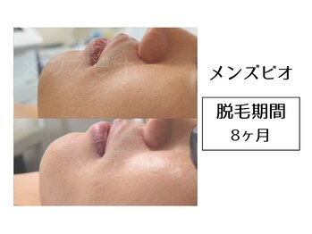 メンズビオ 神戸三宮店/