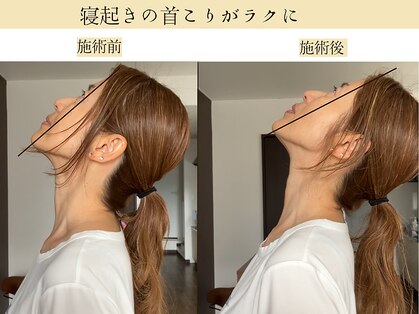 サッカ(札佳 sakka)の写真