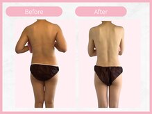 RHB東戸塚/痩身エステはRHB東戸塚