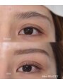 フェリーチェビューティー 大宮西口店(felice BEAUTY)&nbsp;セットメニュー