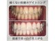 プティー(putih)の写真/【Open記念実施中】“清潔感”を手に入れたい方必見!「速攻性」×「結果」のセルフホワイトニングサロン◎