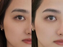 ネストアイ(NEST eye)の雰囲気（派手過ぎないのにちゃんと目元が整う。印象が変わる施術。）